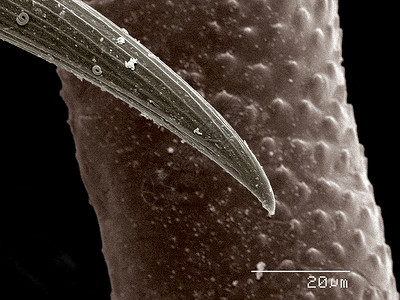 瓢虫幼虫跗骨扫描电镜图片