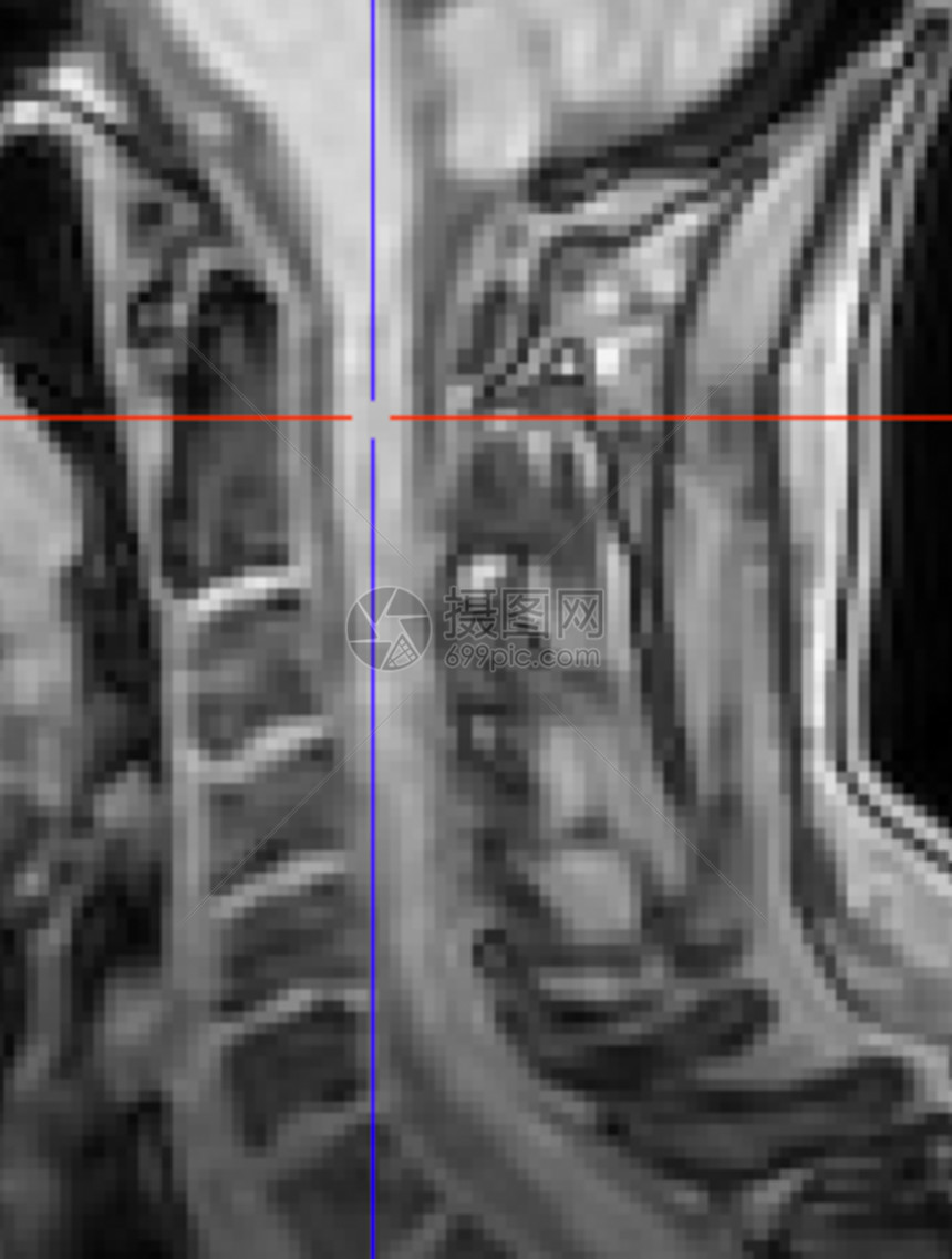 医学磁共振成像图片