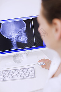 在计算机屏幕上观看X光图像的牙医图片