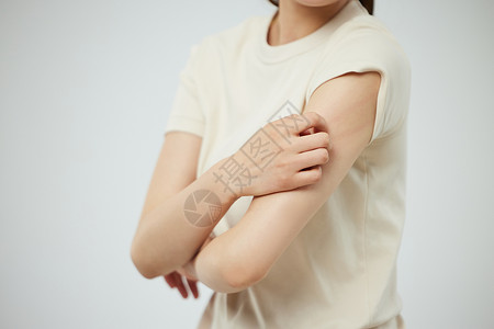 皮肤瘙痒挠抓的女性手臂局部特写高清图片