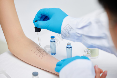 药品检测研究人员在实验者手臂上滴试剂背景
