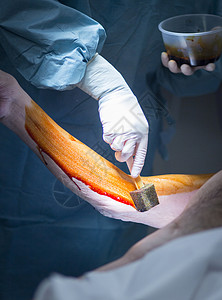 医院手肘术紧急矫形手动术背景图片