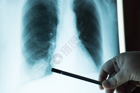 检查胸前X光片的医生检查肺部图片