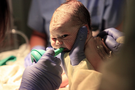 剖宫产新生女孩生命的最初几分钟背景