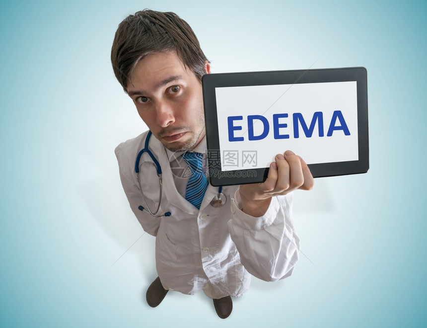 医生在平板电脑上显示爱德玛的诊断图片
