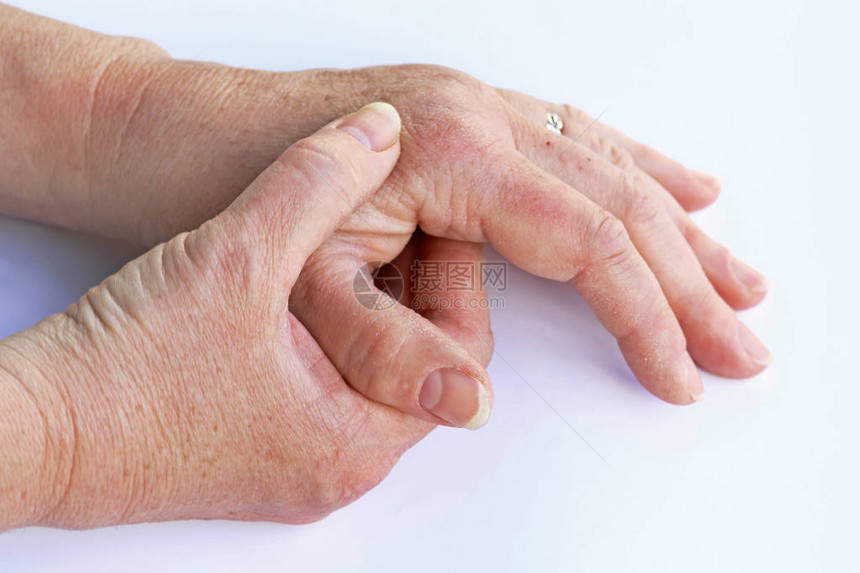 一名年长妇女手部疼痛图片