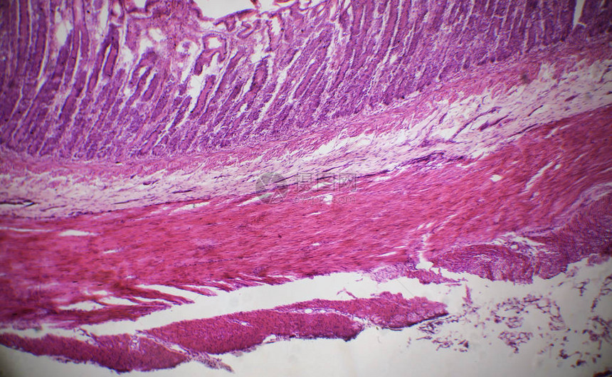 显微镜下的小肠切片图片