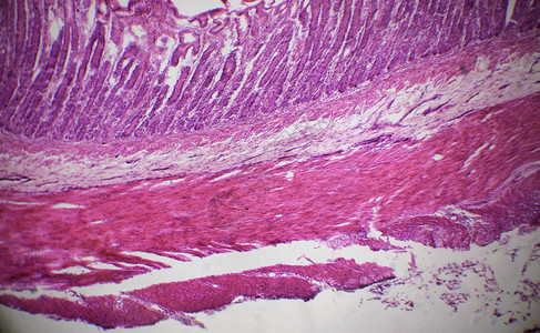 显微镜下的小肠切片图片