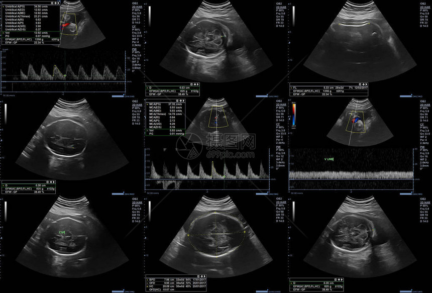 9张超声胎儿图片拼贴图片