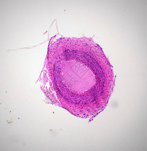 显微镜下的动脉切片图片