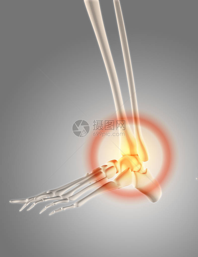 3D骨架骼折脚踝图片