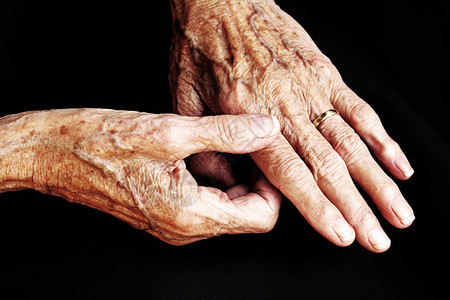 一个老妇人的手疼图片