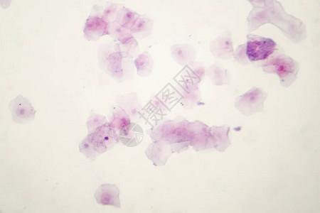 人涂片显微镜下显示黏膜脱屑鳞状细胞光显微照片苏图片