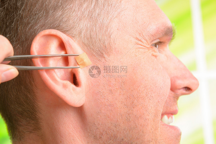 耳针疗法或耳针疗法或耳针疗法或耳针疗法是基于耳朵是反映整个身体的微系统这一思想的图片