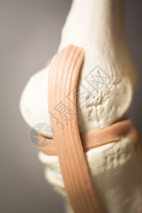 膝关节骨膜炎为肿瘤学和矫形科的图片
