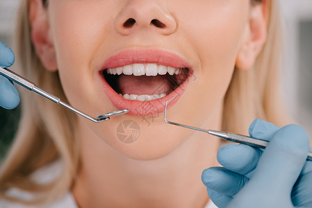 牙科医生用嘴镜和牙探针检查年轻女牙齿的切口镜高清图片