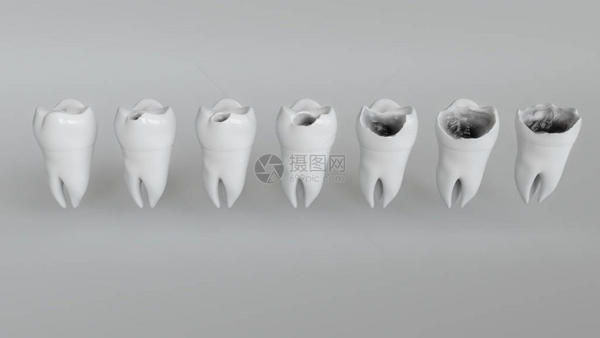 3D种子的摩尔角图片