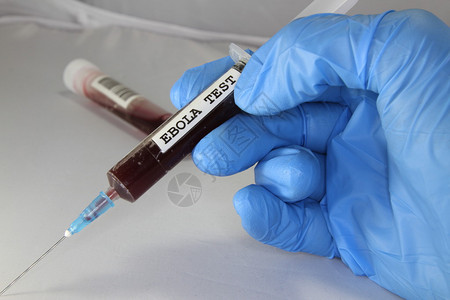 在流行病期间进行伊波拉检测的血型注背景图片