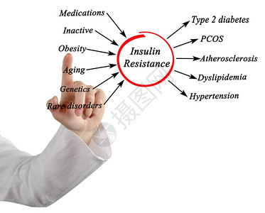 胰岛素抵抗的原因图片