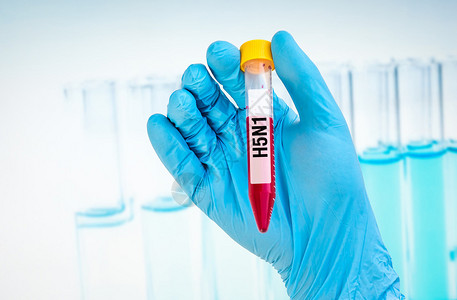 在H5N1测试中科学家手握带有血图片