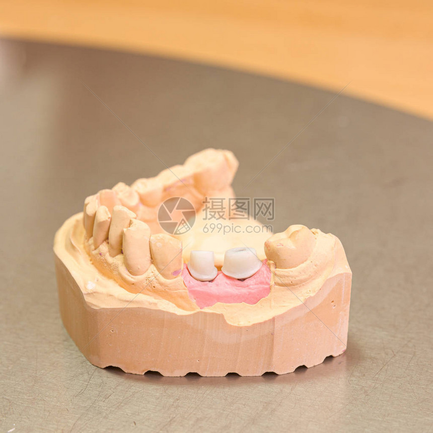 在可供使用的牙科化验室内用人工沉积的图片