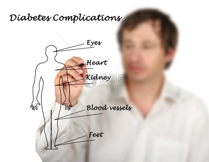 糖尿病并发症图片