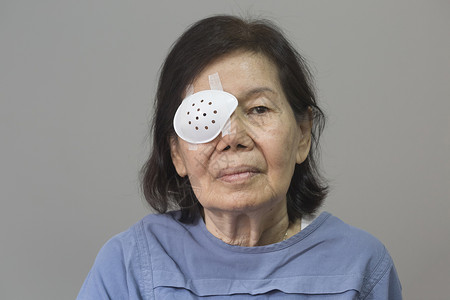 白内障手术后的眼罩覆盖图片