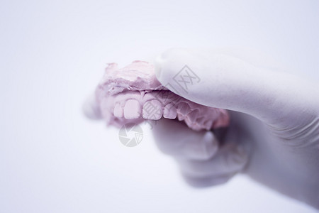 牙科模具牙医粘土牙板陶瓷彩铸模型显示牙科诊所手术中患者的蛀牙和龈图片