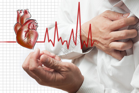 心脏病发作和心跳电图高清图片