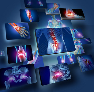 麦迪西那人体关节概念与身体的骨骼解剖学与一组疼痛关节面板发光作为医疗保健和医疗症状的疼痛和伤害或关节背景