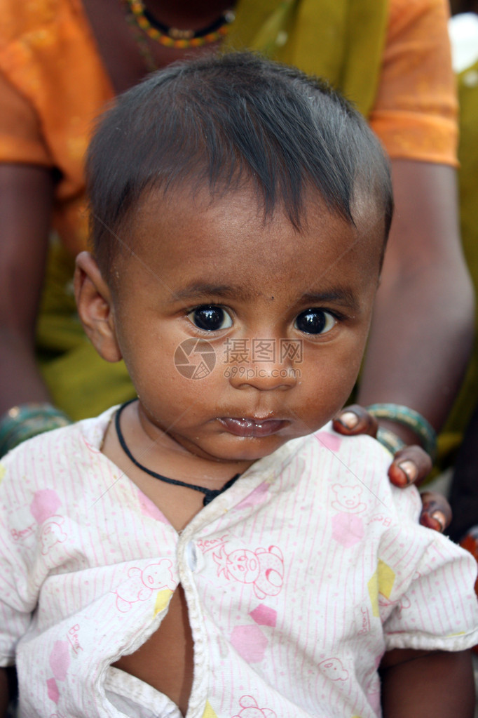 一个可爱的婴儿生病因为在印度贫困地图片