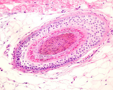 横截面中人类毛囊的层数图片