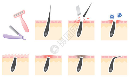 剃须皮肤问题图片