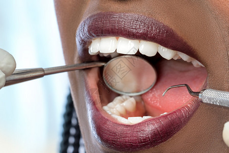 非洲妇女进行牙科检查的极端特写图片