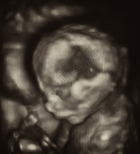 3D意大利实验室第四月胎儿四图片