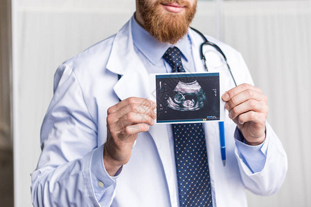 关于对未出生婴儿进行超声波扫描的笑着留胡子男图片