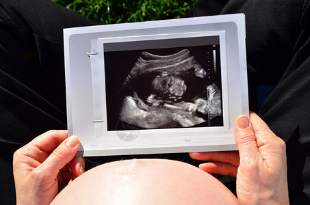 孕妇看着婴儿的超声波扫描图片