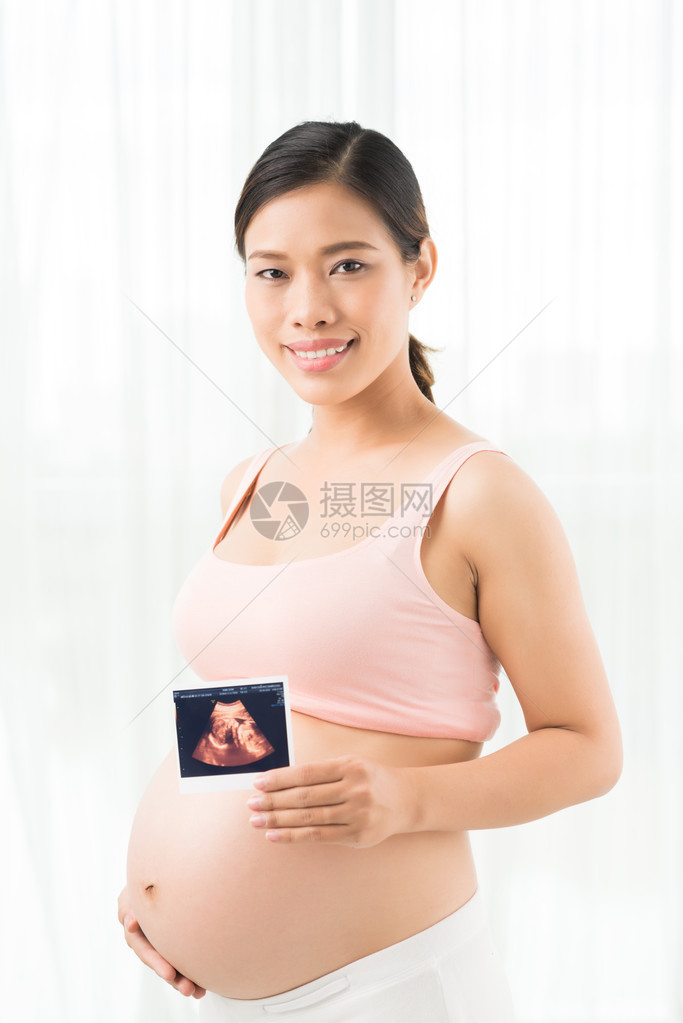 越南孕妇手上有声波图的图片