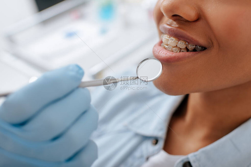 戴着乳胶手套的正畸医生拿着牙镜靠近戴着牙套的快乐非洲裔美图片