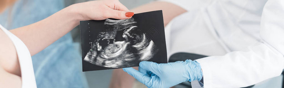 向孕妇进行超声波扫描的医生图片
