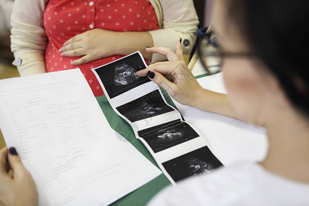 年轻孕妇在医生办公室图片