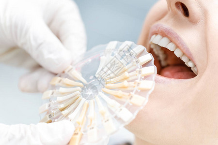 将病人牙齿与样本进行比较的牙科医生部分近图片