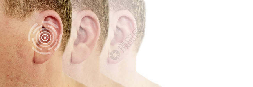 听力损失男症状图片