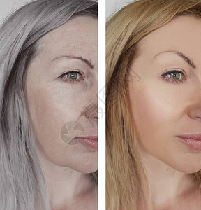 女人在衰老前后皱纹的概念图片