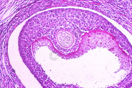 卵巢泡背景图片