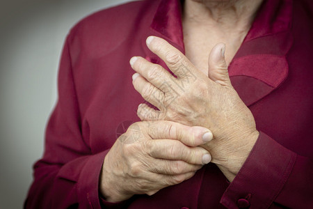 因类风湿关节炎而变形的女人的手疼痛图片