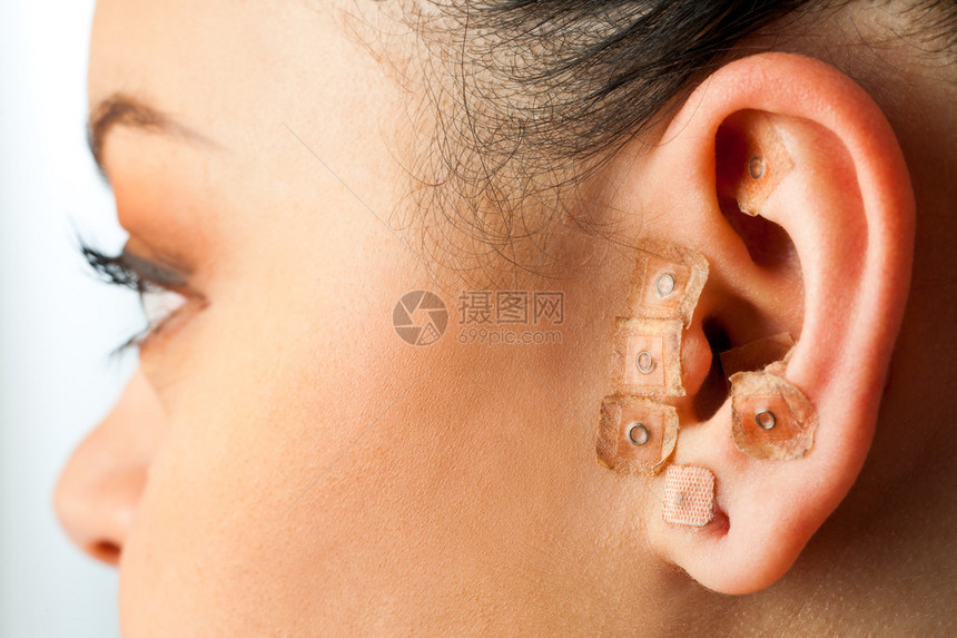 宏观关闭女耳朵上的耳穴疗法图片