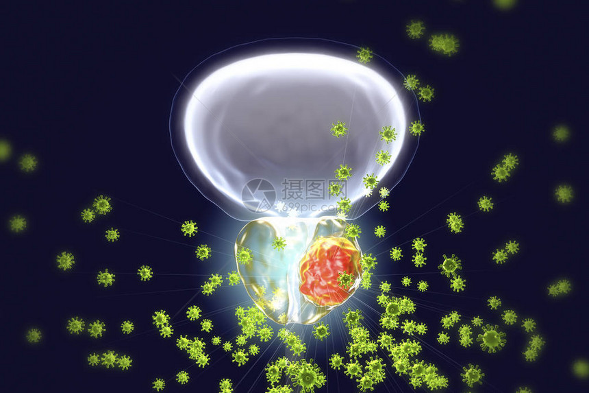 前列腺癌原学的概念图3D插图显示感染前列腺并发图片