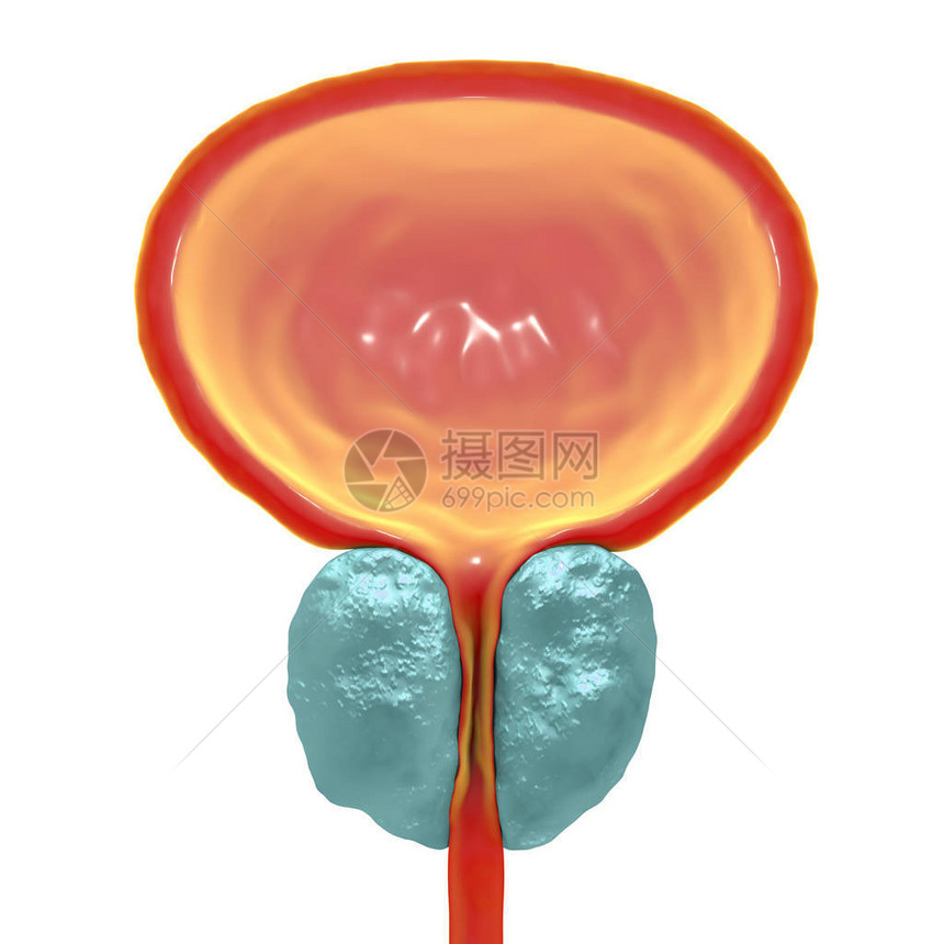 3D显示前列腺扩大的3D图图片