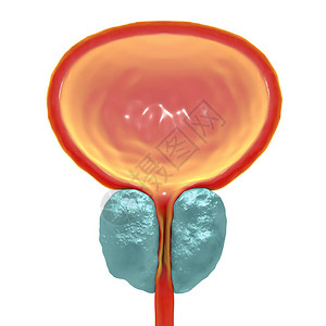 腺瘤3D显示前列腺扩大的3D图设计图片